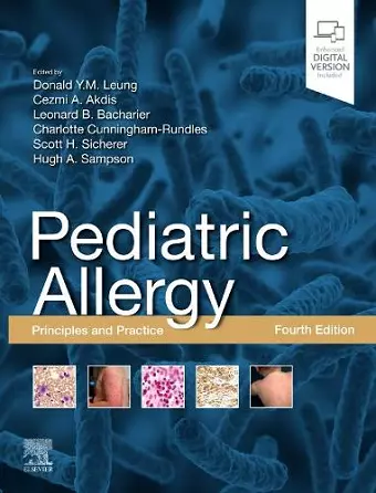 Pediatric Allergy: Principles and Practice cover