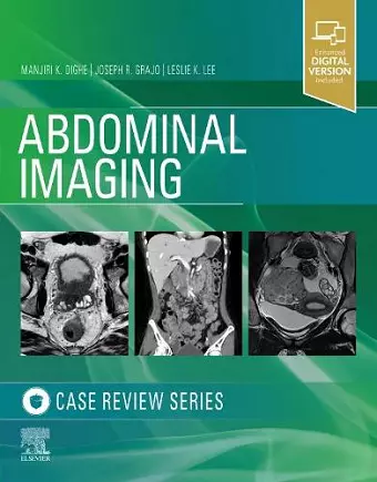 Abdominal Imaging cover