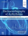 Electrocardiography of Arrhythmias: A Comprehensive Review cover