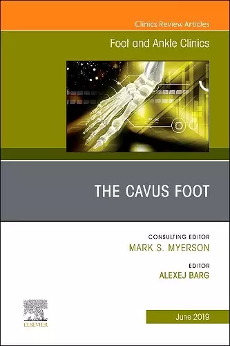 The Cavus Foot, An issue of Foot and Ankle Clinics of North America cover