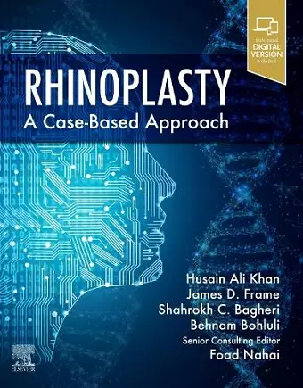 Rhinoplasty cover