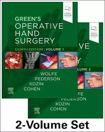 Green's Operative Hand Surgery cover