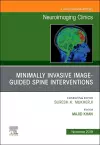 Spine Intervention, An Issue of Neuroimaging Clinics of North America cover