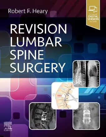 Revision Lumbar Spine Surgery cover