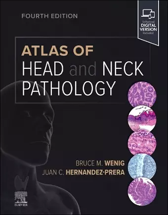 Atlas of Head and Neck Pathology cover