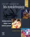 The Technique of Total Knee Arthroplasty cover