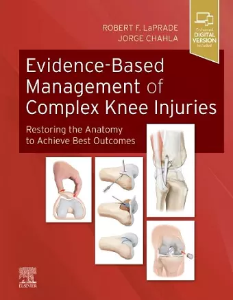 Evidence-Based Management of Complex Knee Injuries cover