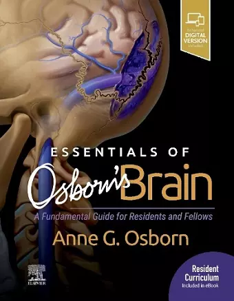 Essentials of Osborn's Brain cover