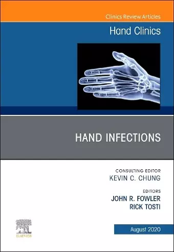 Hand Infections, An Issue of Hand Clinics cover