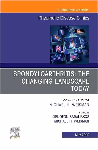 Spondyloarthritis: The Changing Landscape Today, An Issue of Rheumatic Disease Clinics of North America cover