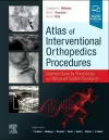 Atlas of Interventional Orthopedics Procedures cover