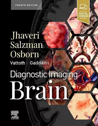 Diagnostic Imaging: Brain cover
