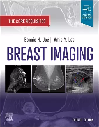 Breast Imaging cover