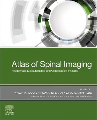 Atlas of Spinal Imaging cover