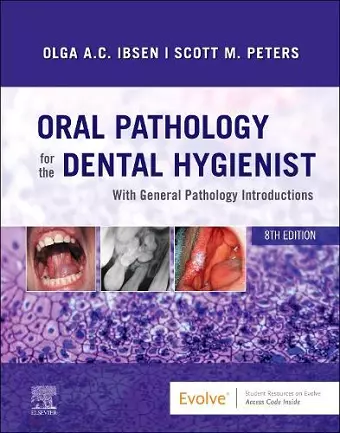 Oral Pathology for the Dental Hygienist cover