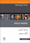 Breast Imaging, An Issue of Radiologic Clinics of North America cover