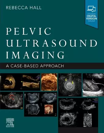 Pelvic Ultrasound Imaging cover