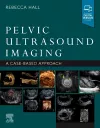 Pelvic Ultrasound Imaging cover