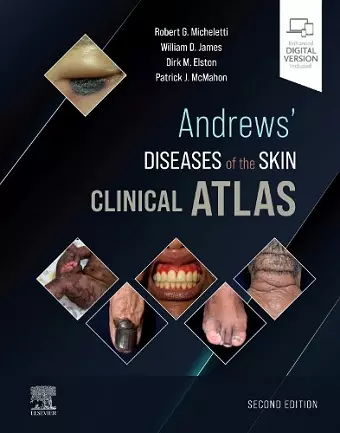 Andrews' Diseases of the Skin Clinical Atlas cover