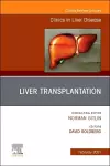 Liver Transplantation, An Issue of Clinics in Liver Disease cover