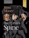 Diagnostic Imaging: Spine cover