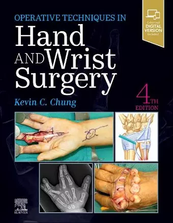 Operative Techniques: Hand and Wrist Surgery cover