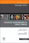 Advanced Neuroimaging in Brain Tumors, An Issue of Radiologic Clinics of North America cover