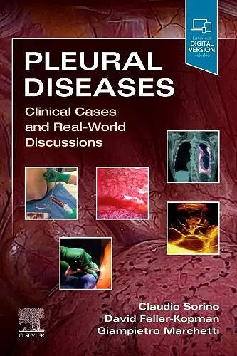 Pleural Diseases cover