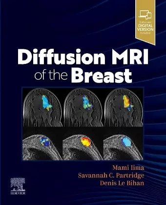 Diffusion MRI of the Breast cover