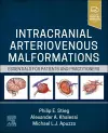 Intracranial Arteriovenous Malformations cover