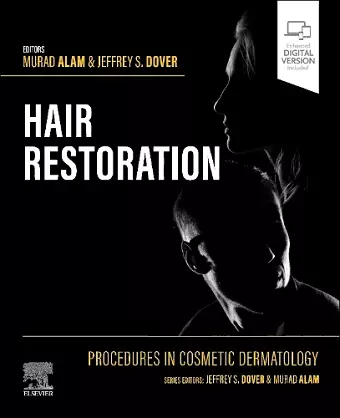 Procedures in Cosmetic Dermatology: Hair Restoration cover