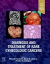 Diagnosis and Treatment of Rare Gynecologic Cancers cover