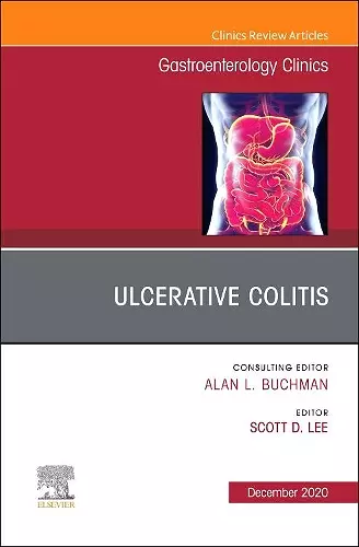 Ulcerative Colitis, An Issue of Gastroenterology Clinics of North America cover