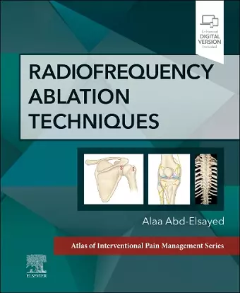 Radiofrequency Ablation Techniques cover