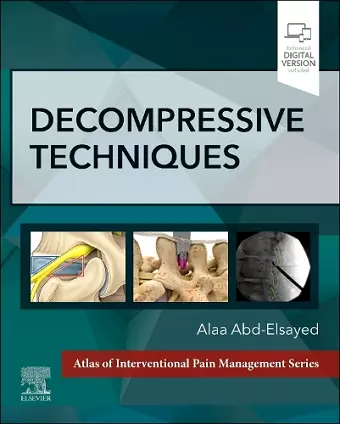 Decompressive Techniques cover