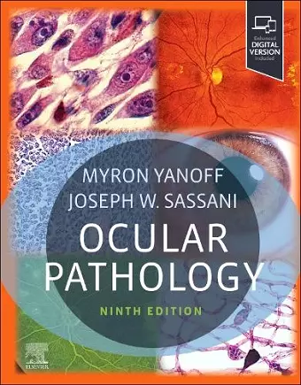 Ocular Pathology cover