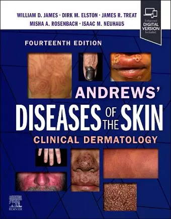 Andrews' Diseases of the Skin cover