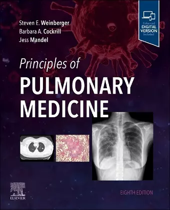 Principles of Pulmonary Medicine cover
