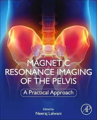 Magnetic Resonance Imaging of The Pelvis cover