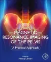 Magnetic Resonance Imaging of The Pelvis cover