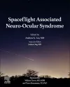 Spaceflight Associated Neuro-Ocular Syndrome cover