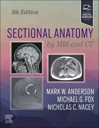 Sectional Anatomy by MRI and CT cover