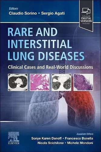 Rare and Interstitial Lung Diseases cover