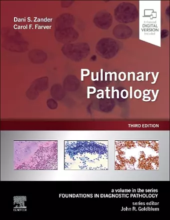 Pulmonary Pathology cover