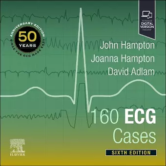 160 ECG Cases cover