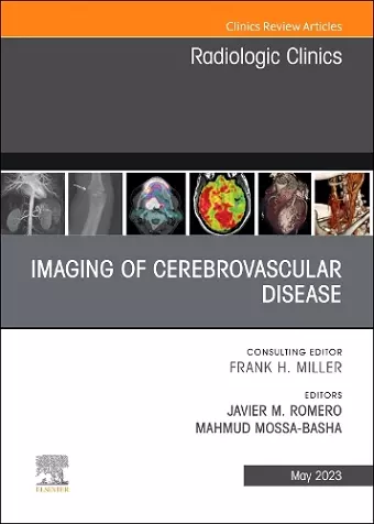 Imaging of Cerebrovascular Disease, An Issue of Radiologic Clinics of North America cover