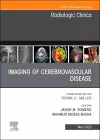 Imaging of Cerebrovascular Disease, An Issue of Radiologic Clinics of North America cover