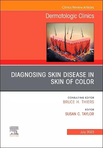 Diagnosing Skin Disease in Skin of Color, An Issue of Dermatologic Clinics cover