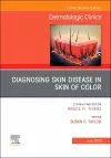 Diagnosing Skin Disease in Skin of Color, An Issue of Dermatologic Clinics cover