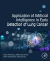 Application of Artificial Intelligence in Early Detection of Lung Cancer cover